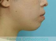 前歯の関係など