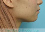 前歯の関係など