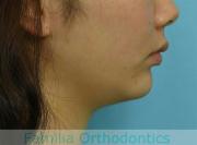 前歯の関係など