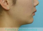 前歯の関係など