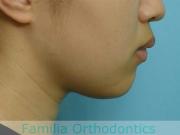 前歯の関係など