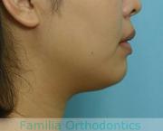 前歯の関係など