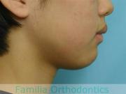 前歯の関係など