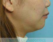 前歯の関係など