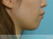 前歯の関係など