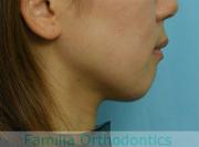 前歯の関係など