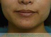 前歯の関係など