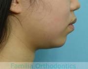 前歯の関係など