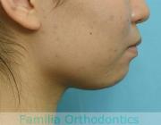 前歯の関係など