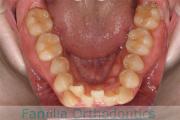 下顎