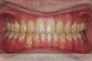 正面