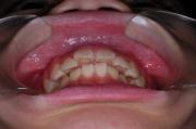 前歯の関係など