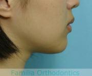 前歯の関係など