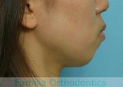 前歯の関係など