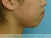 前歯の関係など