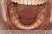 下顎