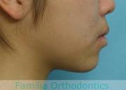 前歯の関係など