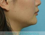 前歯の関係など